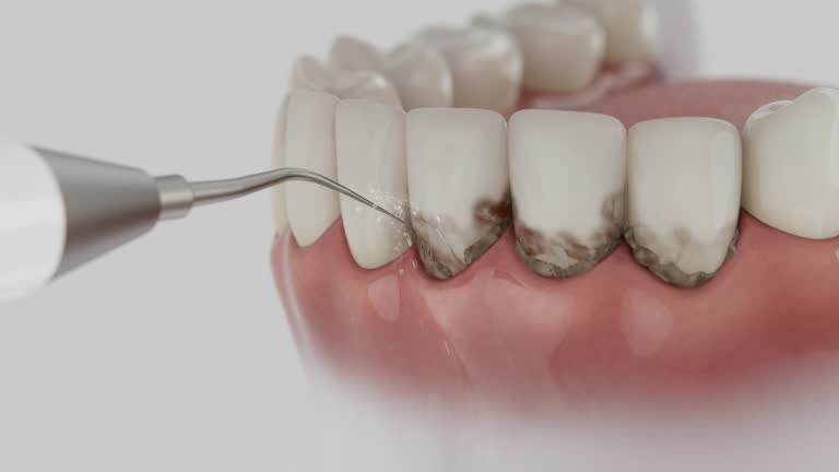 Trusted Dental Implants service in Grangeville, ID - Dentist Open Now